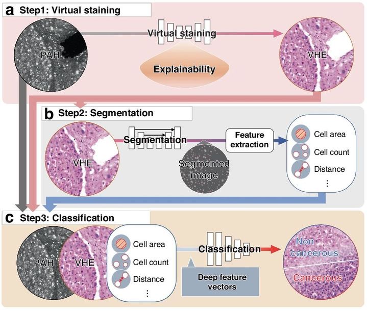 [서울=뉴시스] 9일 서울성모병원·포스텍 연구팀은 PAH에 최첨단 AI 기술을 결합해 가상 염색, 분할, 분류 단계를 수행해 인간 조직 영상을 분석하는 딥러닝 모델을 개발했다고 밝혔다. (사진=서울성모병원 제공) 2024.09.09. photo@newsis.com&nbsp; *재판매 및 DB 금지