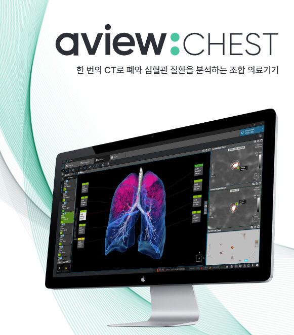 [서울=뉴시스] 26일 AI의료 전문기업 코어라인소프트는 내달 2일부터 5일까지 코엑스에서 개최되는 대한영상의학회 학술대회(KCR)에 참가한다고 밝혔다. (사진=코어라인소프트 제공) 2024.09.26. photo@newsis.com *재판매 및 DB 금지