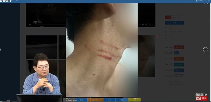 [서울=뉴시스] (사진= 한문철 TV 유튜브 캡처) *재판매 및 DB 금지