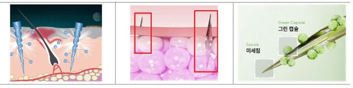 [서울=뉴시스] 사용방법을 피부 내 주입하는 제품으로 광고(이미지)한 화장품 적발 사례 (사진=식약처 제공) 2024.11.16. photo@newsis.com *재판매 및 DB 금지