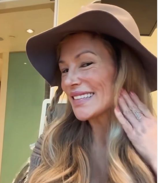 [서울=뉴시스]미국의 리얼리티 쇼에 출연한 스타가 기생충 때문에 자신의 얼굴이 망가졌다고 주장해 충격을 안겼다.(사진=브랜디 글랜빌 SNS) *재판매 및 DB 금지