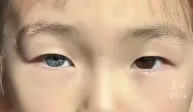 [서울=뉴시스] 중국에서 7세 여아의 양쪽 눈동자 색깔이 달라 화제가 되고 있다. (사진=지무뉴스) *재판매 및 DB 금지