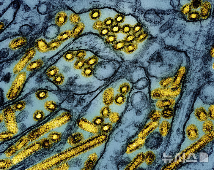 [워싱턴=AP/뉴시스]미 국립알레르기전염병연구소(NIAID)가 지난 3월26일 공개한 컬러 전자현미경 사진 속에 매딘다비 송곳니 신장(MDCK) 상피세포(파란색)에서 자란 조류인플루엔자 A H5N1 바이러스 입자(노란색)가 보이고 있다. 미 보건 당국은 18일(현지시각) 조류 인플루엔자(AI)로 인한 최초의 중증 질환이 미국에서 발생했다고 확인했다. 2024.12.19.