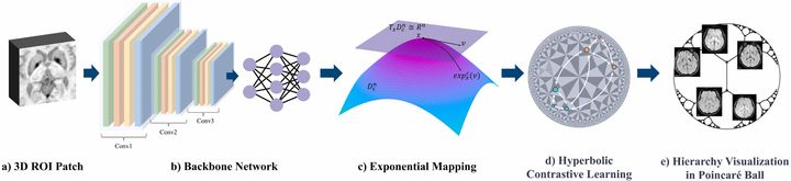 [부산=뉴시스] 부산대학교 정보컴퓨터공학부 감진규 교수팀과 양산부산대학교병원 뇌신경센터 이재혁 교수팀은 공동연구를 통해 적은 데이터로도 높은 정확도를 자랑하는 혁신적인 AI 기반 진단 기술을 개발했다고 26일 밝혔다. 사진은 비정형 파킨슨 증후군 진단 시스템. (사진=부산대 제공) 2024.12.26. photo@newsis.com *재판매 및 DB 금지