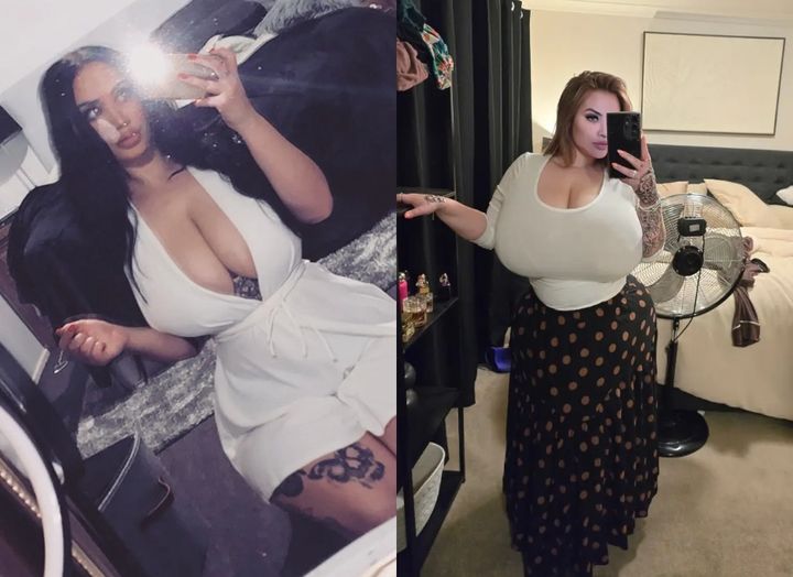 [서울=뉴시스] '거대유방증'을 앓고 있는 호주 여성 페이지 아멜리아(29). (사진=뉴욕포스트) *재판매 및 DB 금지