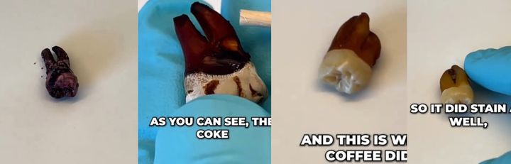 [서울=뉴시스]치과의사 마일스 매디슨이 네 가지 음료가 치아에 미치는 착색 효과를 실험한 결과가 충격적이다. 순서대로 레드와인, 콜라, 커피, 차.(사진=틱톡) *재판매 및 DB 금지