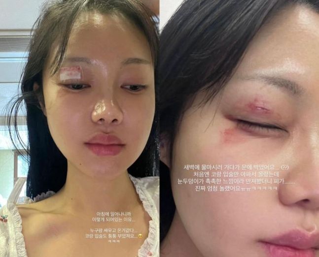 [서울=뉴시스] 김연지. (사진=김연지 인스타그램 캡처) 2025.02.03. photo@newsis.com&nbsp; *재판매 및 DB 금지