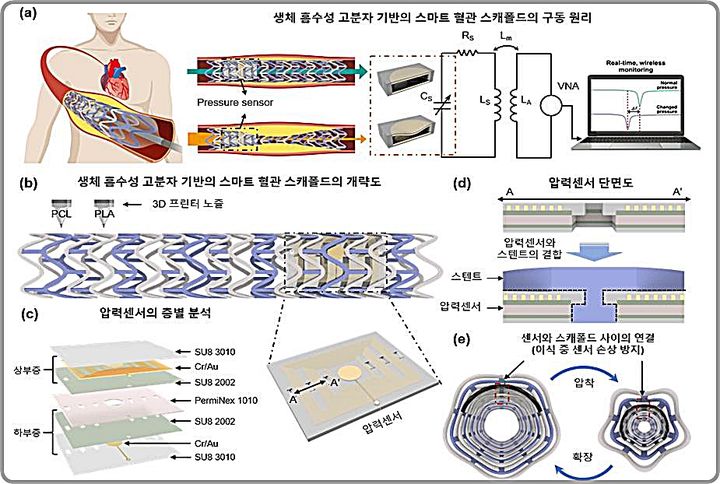[대전=뉴시스] 3D 프린터를 이용한 SH-BVS 제작 및 혈관 내 실시간 모니터링을 위한 LC 무선 압력센서와의 통합 기술 개요도.(사진=생기원 제공) *재판매 및 DB 금지