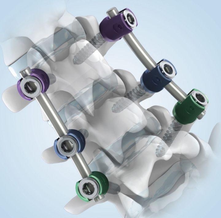 [서울=뉴시스] 시지메드텍의 ANAX 5.5 (사진=시지메드텍 제공) 2025.02.21. photo@newsis.com *재판매 및 DB 금지