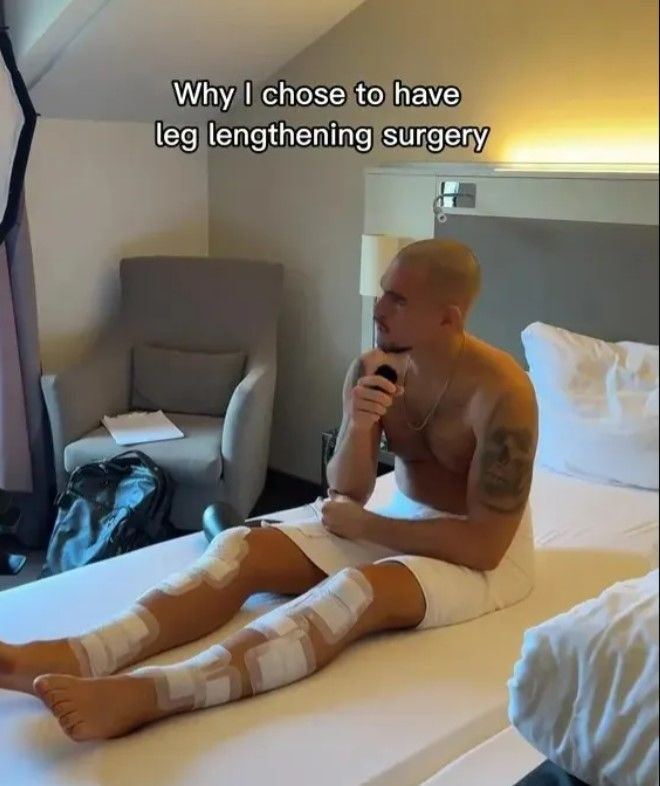 [서울=뉴시스] 작은 키 때문에 놀림 받던 미국의 20대 남성이 사지연장술을 받아 키가 20.5㎝ 늘어난 사연이 전해져 화제다. (사진= 더선 캡처 ) 2025.03.02. photo@newsis.com *재판매 및 DB 금지