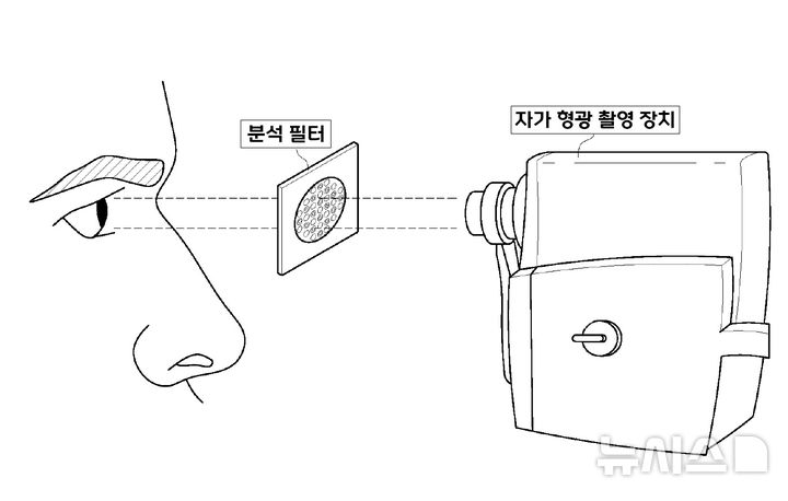 [서울=뉴시스]국내 의료진이 특정 필터로 자가 형광(Autofluorescence·AF) 신호를 정밀하게 촬영해 백내장과 노안 등 수정체 이상을 정량적으로 평가할 수 있는 기술을 세계 최초로 개발했다. 기존 백내장 진단의 경우 의료진의 주관이 개입할 수 있는 만큼 보다 객관적인 진단이 가능해질 것으로 보인다. (사진= 고려대 안산병원 제공) 2025.03.19. photo@newsis.com. 