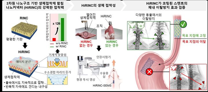 3차원 나노구조 기반 생체접착제 함침 나노커넥터(HiRINC)가 코팅된 스텐트의 체내 이탈방지 효과 모식도. (사진=한양대 제공) *재판매 및 DB 금지