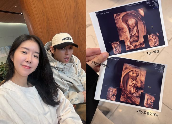 [서울=뉴시스] 김지혜·최성욱(왼쪽), 초음파 사진 (사진=인스타그램 캡처) 2025.03.28. photo@newsis.com *재판매 및 DB 금지