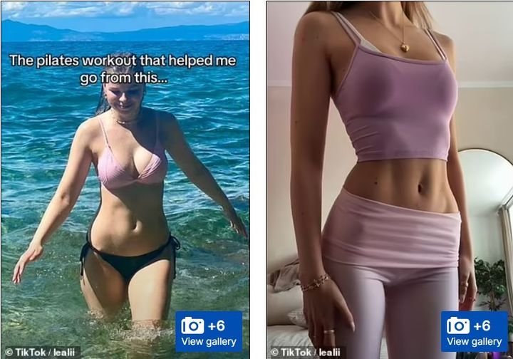 [뉴시스]인플루언서 레알리의 다이어트 전후 사진(사진=데일리메일 캡처) 2025.4.3 *재판매 및 DB 금지