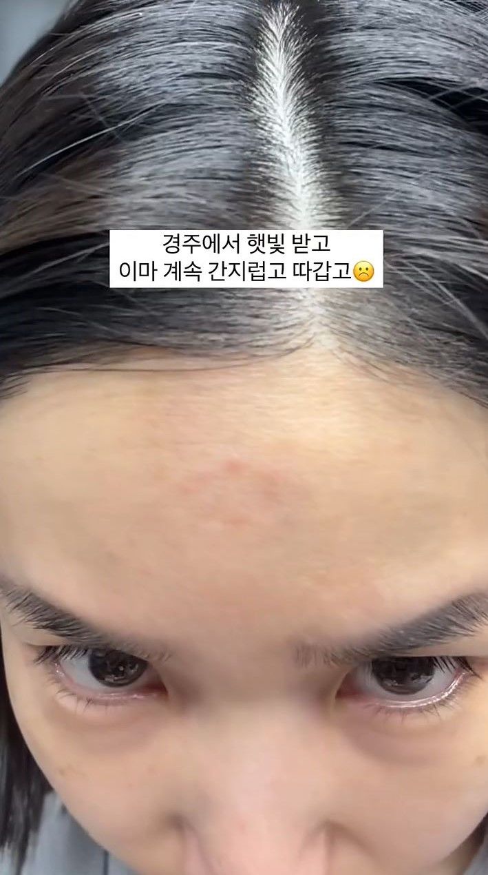 [서울=뉴시스] 그룹 '크레용팝' 출신 초아가 '텐트런' 후유증을 고백했다. (사진=초아 인스타그램 캡처) 2025.04.03. photo@newsis.com *재판매 및 DB 금지