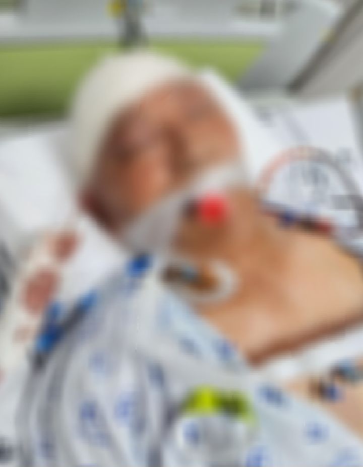 [서울=뉴시스] 보배드림에 올라온 폭행 이후 피해자의 모습이다 (사진=보배드림 캡쳐) 2025.04.06. photo@newsis.com *재판매 및 DB 금지