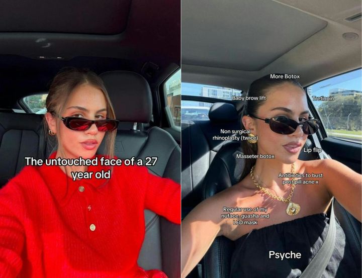 [서울=뉴시스] 지난 6일(현지 시간) 뉴욕포스트 등 현지 매체는 이러한 흐름을 '트윅먼트(Tweakment)'로 소개하며, "자연스러운 아름다움을 추구하는 방식이 확산 중"이라고 전했다. (사진= 호주 Contour 클리닉 설립자 '조쉬 월' 틱톡 캡처 ) 2025.04.09. photo@newsis.com *재판매 및 DB 금지