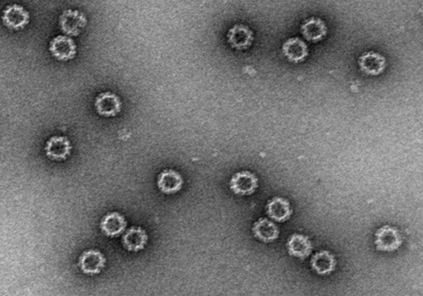 [서울=뉴시스] 노로바이러스 바이러스 유사입자(VLP) 전자현미경 사진 (사진=인테라 제공) 2025.04.18. photo@newsis.com *재판매 및 DB 금지