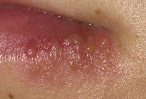 私はカラオケに行き、私の人生を変えました…「この病気」感染症は8年間苦しんでいます