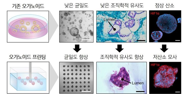 [울산=뉴시스] 구미현 기자 = 기존 암 오가노이드와 구슬 형태로 3D 바이오프린팅된 암 오가노이드 모델의 차이를 설명한 연구그림 (사진=UNIST 제공) 2025.04.29. photo@newsis.com *재판매 및 DB 금지