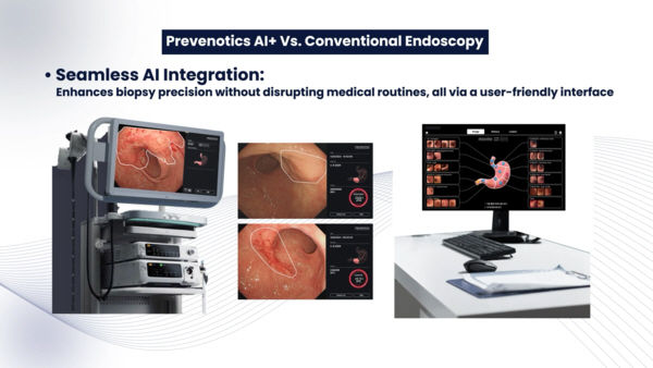 [서울=뉴시스] 2일 의료기기업계에 따르면 프리베노틱스가 개발한 '베노틱스-지프로'는 AI를 기반으로 소화기 암 분야에서 전조 증상을 잡아낸다. (사진=프리베노틱스 제공) 2025.05.02. photo@newsis.com *재판매 및 DB 금지
