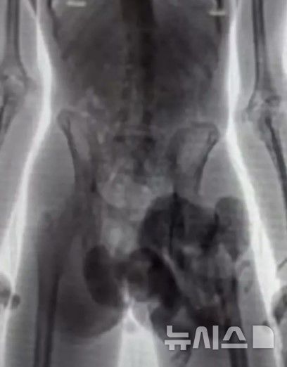 [서울=뉴시스](사진=데일리메일)