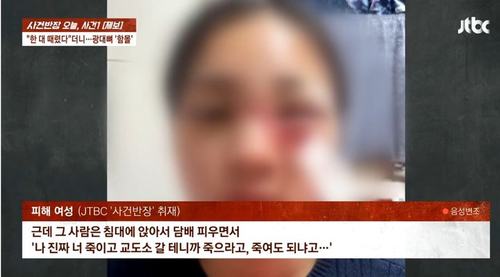 [서울=뉴시스] 폭행으로 인해 광대뼈가 함몰된 여성의 모습. (사진= '사건반장' 유튜브 캡처) 2025.05.09. *재판매 및 DB 금지