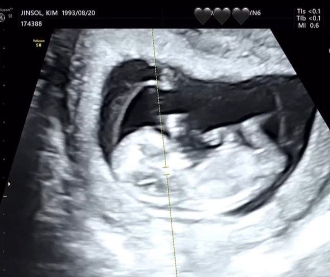 [서울=뉴시스] 트루디가 임신 소식과 함께 태아 초음파 사진을 공개했다. (사진=트루디 인스타그램 캡처) 2025.05.09. photo@newsis.com&nbsp; *재판매 및 DB 금지