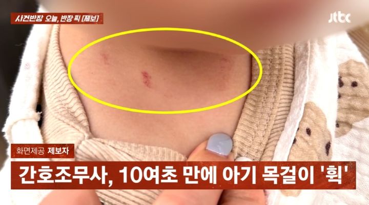 [서울=뉴시스] 간호조무사가 금목걸이를 빼는 과정에서 아기 목에 상처가 생겼다.(사진=JTBC '사건반장' 캡쳐) 2025.05.12 *재판매 및 DB 금지