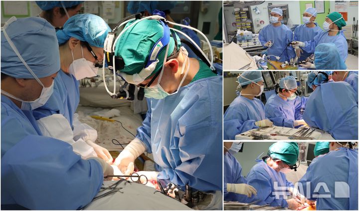 [서울=뉴시스]서울아산병원 간이식팀이 지난달 30일 네 개의 수술방에서 생체 간이식 두 건을 동시에 시행하고 있다. 간이식팀은 8999번째와 9000번째 간이식을 연달아 성공하면서 간이식 9천례를 달성했다. (사진= 서울아산병원 제공) 2025.05.15. photo@newsis.com. 