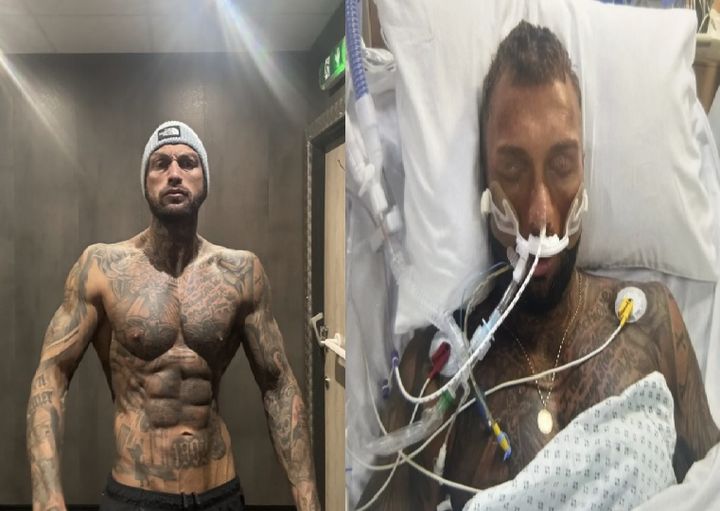 [서울=뉴시스] 15일(현지시각) 영국 데일리메일 등 외신은 근육을 늘리고자 2년 넘게 스테로이드를 복용해 온 30대 남성이 부작용으로 혼수상태에 빠진 사연을 보도했다. (사진=SWNS 캡처) 2025.05.19 *재판매 및 DB 금지