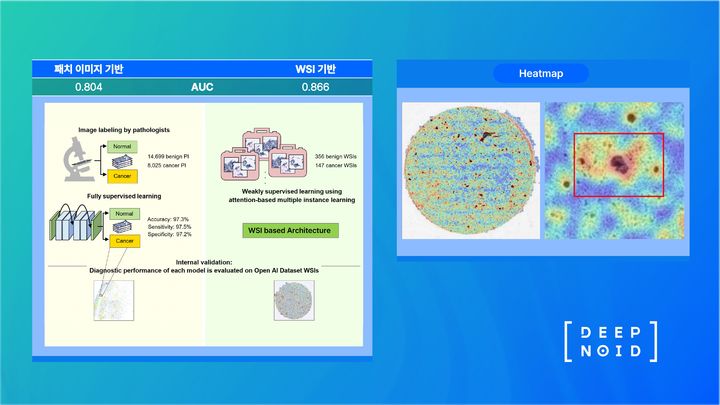 [서울=뉴시스] 22일 딥노이드는 가톨릭의대 의정부성모병원와의 공동 연구 논문이 국제 학술지에 게재되며 인공지능(AI) 진단의 우수성이 입증됐다고 밝혔다. (사진=딥노이드 제공) 2025.05.22. photo@newsis.com *재판매 및 DB 금지