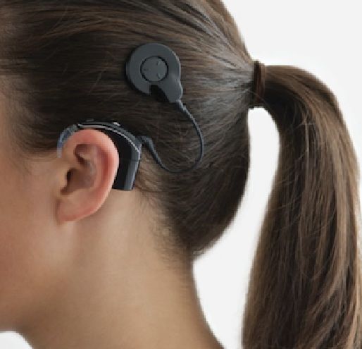 [안동=뉴시스] 인공와우 시술 모습. (사진=경북교육청 제공) 2025.05.26 photo@newsis.com *재판매 및 DB 금지