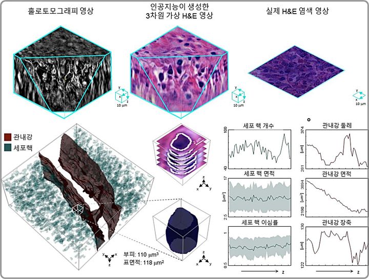 [대전=뉴시스] 인공지능 기반 3차원 가상 H&E 염색 및 병리조직 정량분석 결과. 가상 염색 영상은 주요 병리학적 특징을 3차원으로 복원가능하며 이를 바탕으로 세포핵 분포, 부피, 표면적 등 다양한 정량지표를 추출할 수 있다.(사진=KAIST 제공) *재판매 및 DB 금지