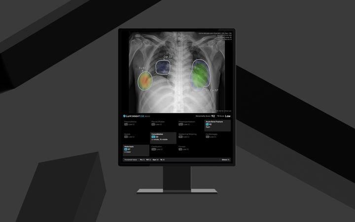 [서울=뉴시스] 의료 인공지능(AI) 기업 루닛은 AI 흉부 엑스레이 진단 솔루션 신제품 '루닛 인사이트 CXR4'가 유럽 의료기기 규정 'CE MDR(Medical Device Regulation)' 인증을 획득했다고 28일 밝혔다. (사진=루닛 제공) 2025.05.28. photo@newsis.com *재판매 및 DB 금지