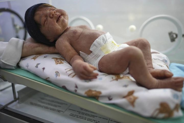 [상파울루=AP/뉴시스] 브라질 캄피나스의 한 매장에서 판매 중인 리본돌이 인큐베이터에 누워 있다. 2025.05.24 photo@nesis.com *재판매 및 DB 금지