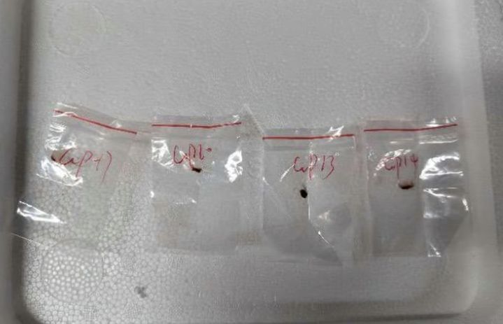 [서울=뉴시스] 중국인 과학자 2명이 독성 곰팡이 병원체를 배낭에 숨겨 미국으로 밀반입한 혐의로 기소됐다. (사진=사우스차이나모닝포스트 홈페이지 갈무리) 2025.06.04&nbsp; *재판매 및 DB 금지