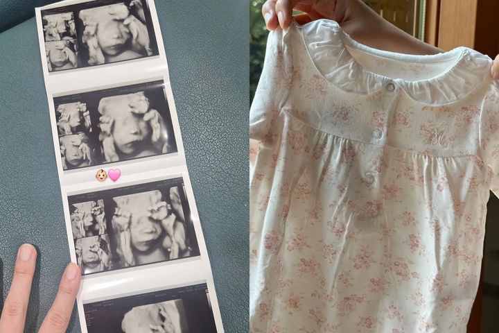 [서울=뉴시스] 박보미 둘째 초음파 사진(왼쪽)·박보미가 지인에게 선물 받은 옷 (사진=박보미 인스타그램 캡처) 2025.06.04. photo@newsis.com *재판매 및 DB 금지