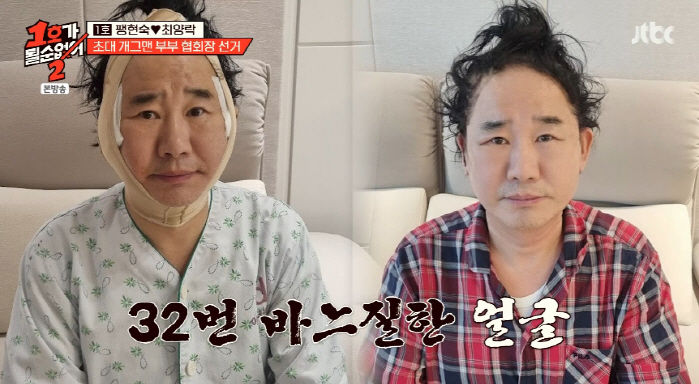 [서울=뉴시스] 개그맨 최양락이 4일 JTBC 예능 프로그램 '1호가 될 순 없어2'에서 쌍꺼풀 수술과 안면 거상술을 받았다고 밝혔다. (사진=JTBC 제공) 2025.06.04 photo@newsis.com *재판매 및 DB 금지