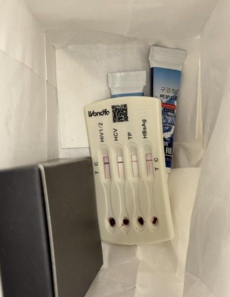 [서울=뉴시스]베이징의 한 고급 호텔에서 혈흔이 남은 인간면역결핍바이러스(HIV) 자가진단 키트가 세면용품에서 발견돼 충격을 주고 있다.(사진=극목신문) *재판매 및 DB 금지