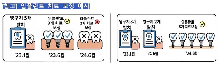 [서울=뉴시스] 임플란트 치료 보장 예시. (사진=금융감독원 제공) 2025.06.24. photo@newsis.com *재판매 및 DB 금지