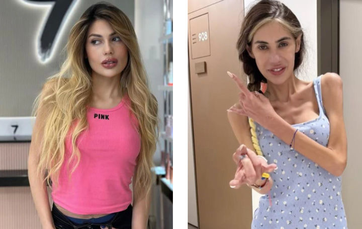 [서울=뉴시스] 인스타그램 팔로워 약 90만 명을 보유한 튀르키예 인플루언서 니할 칸단(30·여)은 지난 21일 병원에서 거식증 치료를 받다가 심장마비로 사망했다. (사진=호주 뉴스닷컴 캡처) 2025.06.27 *재판매 및 DB 금지