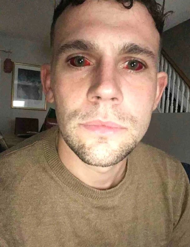 [뉴시스] 15년간 코카인에 중독됐던 한 영국 남성이 5일 연속 코카인을 흡입했다가 겪은 극단적인 경험을 공유하며 약물 중독의 위험성을 경고하고 나섰다. (사진=데이브 멀렌 틱톡 캡처) *재판매 및 DB 금지