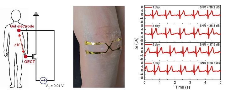 [수원=뉴시스] 피부 부착형 장치를 손가락에 부착하기 위한 심전도 신호 개략도(제일 왼쪽)와 실제로 손가락 관절 부분에 부착해 7일 동안 심전도 신호를 측정한 데이터(가운데 및 오른쪽). 연구팀이 구현한 초박형 센서는 피부에 밀착돼 생체신호 추출의 정확성을 높이며 안정성도 높다. (사진=아주대 제공) 2025.07.02. photo@newsis.com *재판매 및 DB 금지