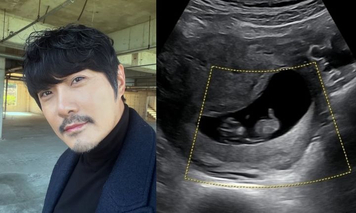 [서울=뉴시스] KCM. (사진=KCM 인스타그램 캡처) 2025.07.08. photo@newsis.com *재판매 및 DB 금지