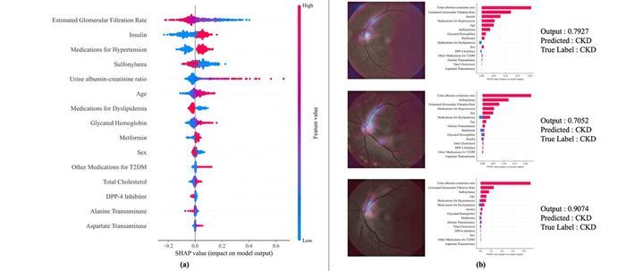 사진은 설명 가능한 AI 기법을 통한 주요 위험 인자 기여도 시각화 결과다. (사진=경희대 제공) *재판매 및 DB 금지