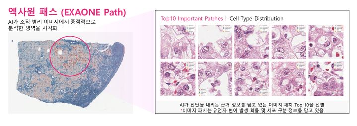 [서울=뉴시스]엑사원 패스는 전체 슬라이드 이미지(WSI)에서 암과 관련된 유전자 변이를 예측할 수 있다. (사진=LG 제공) 2025.07.09. photo@newsis.com *재판매 및 DB 금지