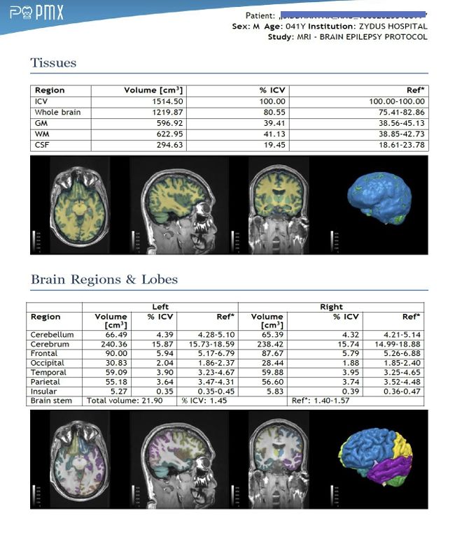 "뇌 MRI 15분이면 끝"...해외서 먼저 알아본 한국 의료AI[빠정예진] - 뉴스 썸네일 이미지