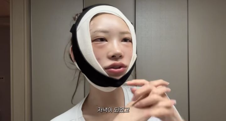 [서울=뉴시스] 최준희가 지난 8일 유튜브 채널 '준희'에 안면 윤곽, 눈 밑 뒷트임 성형수술 후기를 밝혔다. (사진=유튜브 채널 '준희' 캡처) 2025.07.11. photo@newsis.com *재판매 및 DB 금지