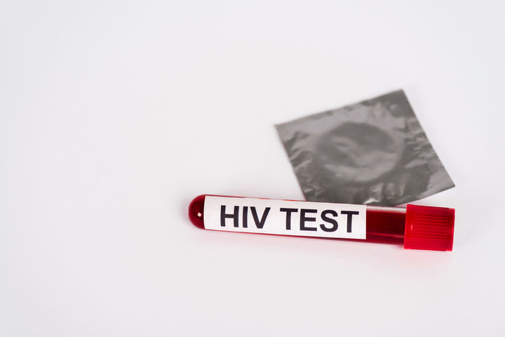 [서울=뉴시스] 태국 젊은 세대 사이에서 HIV(인간면역결핍바이러스) 감염이 빠르게 확산되고 있다. 2025.07.14. *재배포 및 DB금지 *재판매 및 DB 금지
